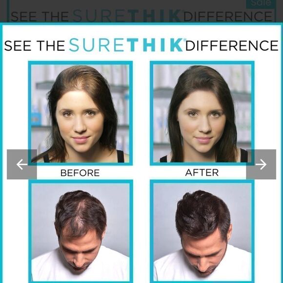 ⭐️SURETHIK Hair Thickening Products Hair Fiber Starter Package-Dark Brown⭐️ - Picture 2 of 4